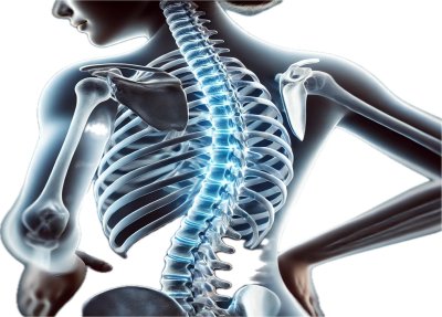 Scoliosis: Symptoms, Causes, and Treatment Options